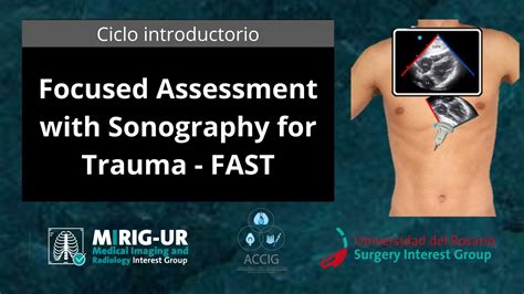 Focused Assessment With Sonography For Trauma Fast Youtube