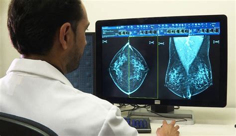 Mammogram Screening Protocols Could Change Because of Recent ...