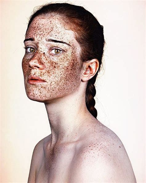 Fotógrafo Retrata A Beleza única De Pessoas Com Sardas