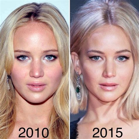 Jennifer Lawrence Plastic Surgery Before After