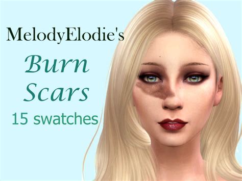 Sims 4 Acne Scars