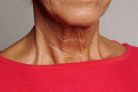 Sagging Neck Causes And How To Tighten 7 Non Surgical Diy Home Tips