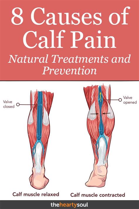 Pulled Muscle Behind Knee And Calf At Sam Lewis Blog