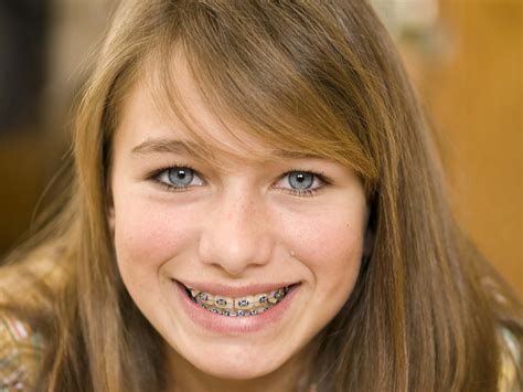 National Orthodontic Health Month Is Observed In October West U Smiles Houston Pediatric