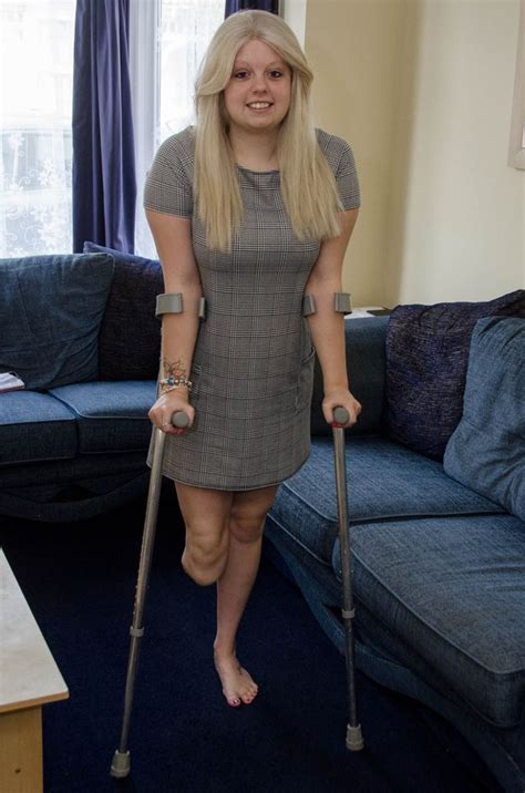 Pin By Morris On Attractive Amputee And Disabled Women Amputee Woman