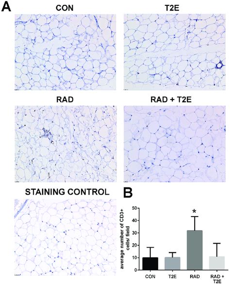 Radiation Significantly Increases Cd3 Cells And Mnte 2 Pyp Blocks This