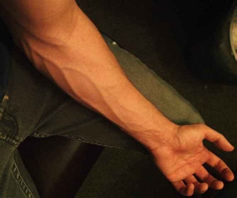 Bulging Veins Pictures Causes Prevention And Treatment