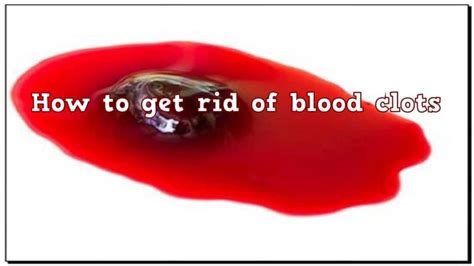 How To Get Rid Of Blood Clot Naturally Health Gadgetsng
