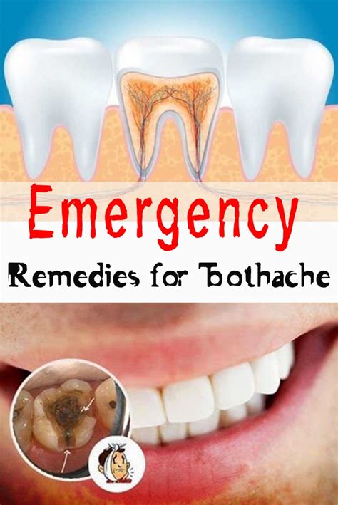 Emergency Remedies For Toothache Everything In One Place