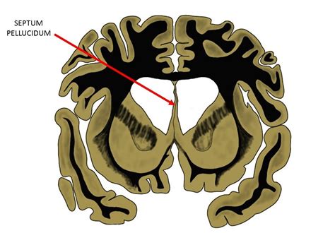 Septum Pellucidum Definition — Neuroscientifically Challenged