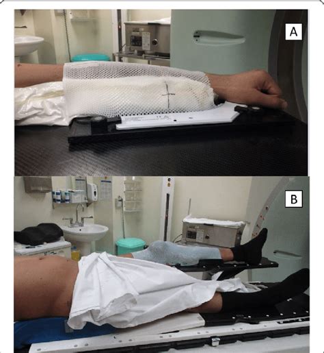 Patients With Thermoplastic Cast Immobilization Device The Figure