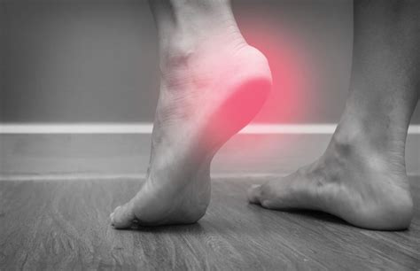 3 Reasons Why Physical Therapy Often Successfully Treats Plantar