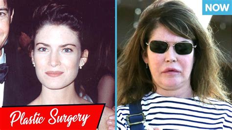 Worst Celebrity Plastic Surgery Disasters Then And Now Youtube