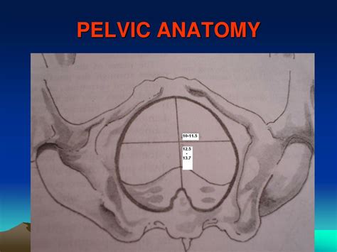 Laparoscopic anatomy of the female pelvic region. PPT - CEPHALO-PELVIC DISPROPORTION PowerPoint Presentation ...