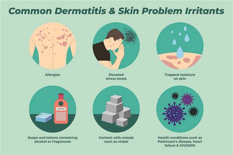 Common Causes Of Dermatitis And Skin Irritants An Illustra Flickr