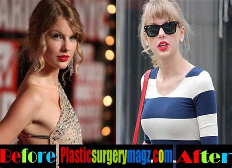 Taylor Swift Boob Job Before And After Pictures Plastic Surgery