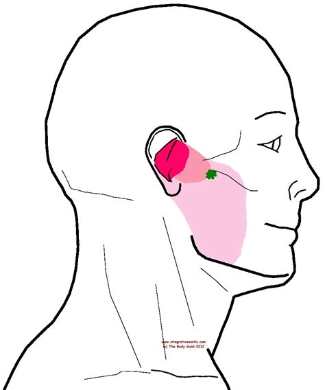 Trigger Points Earache And Jaw Tension Integrative Works