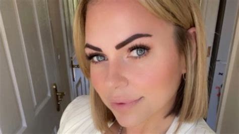Tan Addict Mum Left With Hole In Face After Beauty Spot Turns Out To Be