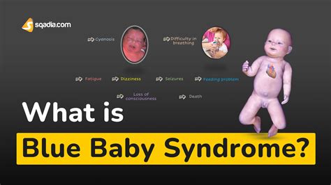 What Is Blue Baby Syndrome Physiology
