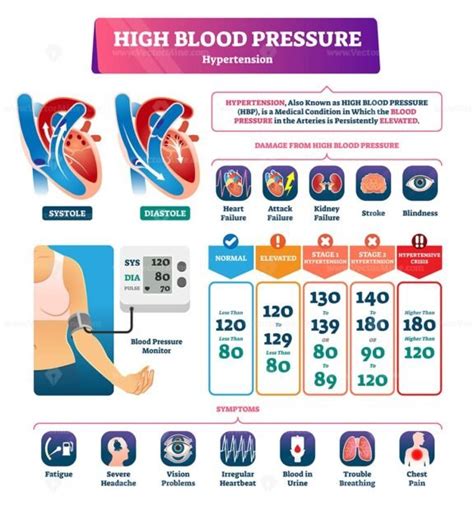 High Blood Pressure Vector Illustration Vectormine