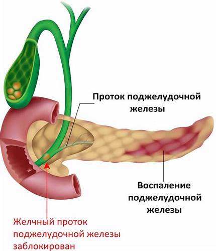 Лечение хронического панкреатита народными средствами Картинка - Лечение хронического панкреатита народными средствами