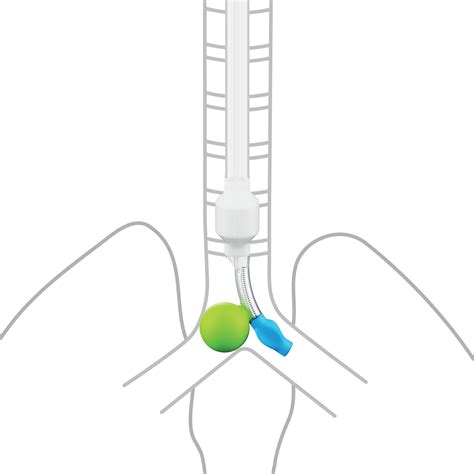 Ventibronc • Double Lumen Endobronchial Tube