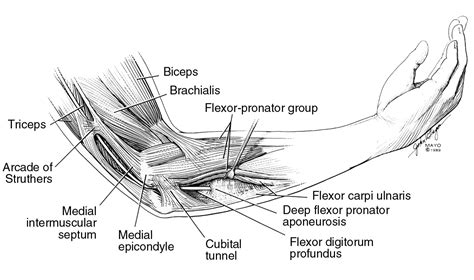 Peripheral Nerve Entrapments Of The Arm Innova Pain Clinic