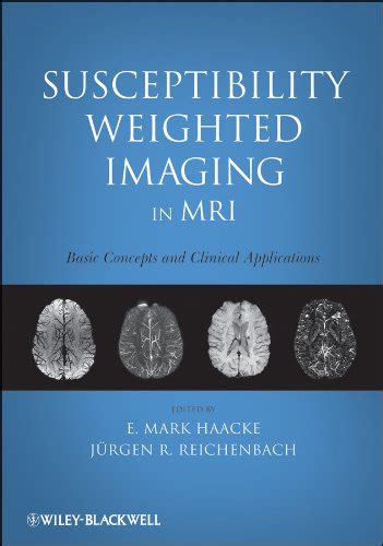 Susceptibility Weighted Imaging In Mri Basic Concepts And Clinical