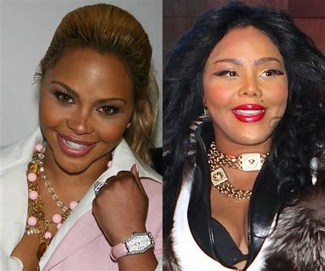 Look At That Massive Transformation Lil Kim Before And After Plastic Surgeries Americas