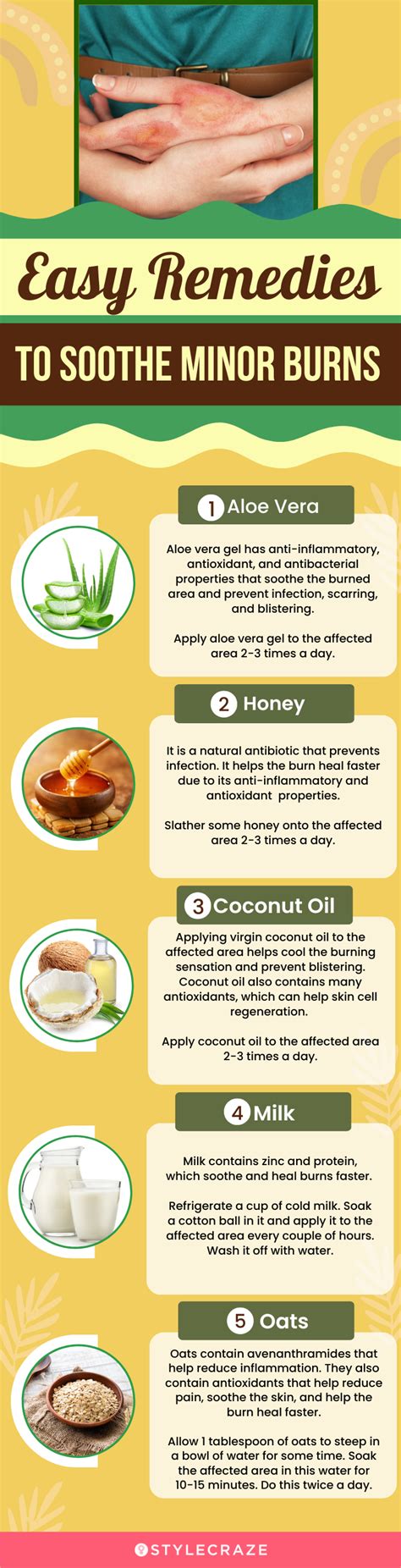 How To Treat Burns At Home 14 Natural Remedies To Try