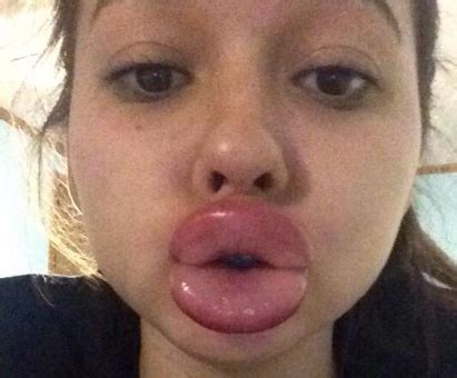 Kyliejennerchallenge Causes Big Trouble Cbs News