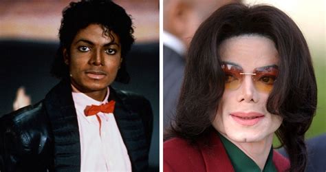 Michael Jackson Plastic Surgery Before And After Nose