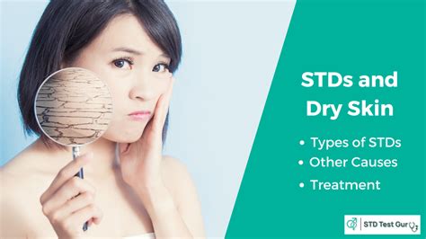 STDs That Cause Dry Skin In Men And Women Symptoms Treatment