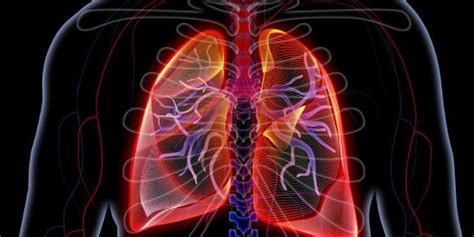 Enfermedad pulmonar intersticial causas síntomas y tratamientos Remedios caseros
