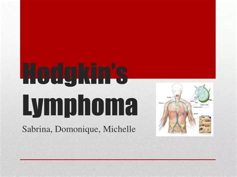 Ppt Hodgkins Lymphoma Powerpoint Presentation Free Download Id