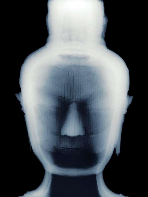 10 Examples Of X Ray Art