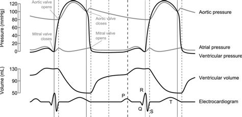 Wiggers Diagram Cardiac Cycle