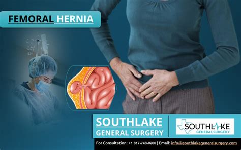 Femoral Hernia Surgery At Southlake General Surgery Southlake General