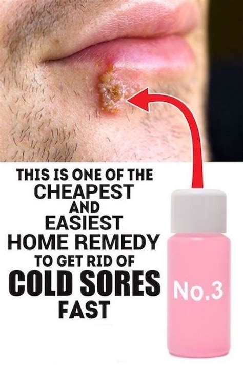 This Is One Of The Cheapest And Easiest Home Remedy To Get Rid Of Cold