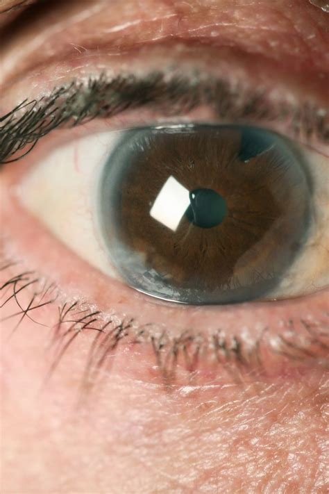 What Your Eyes Can Tell You About Your Health Eye Problems
