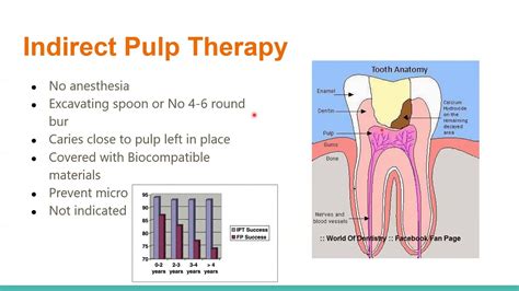 Indirect Pulp Capping In Primary Teeth A Literature Review Youtube