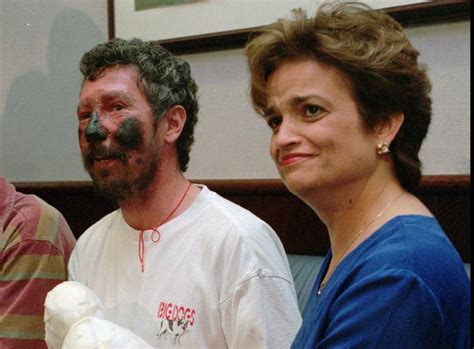 Dr Seaborn Beck Weathers His Face Blackened From Severe Frostbite Sits With His Wife Margaret