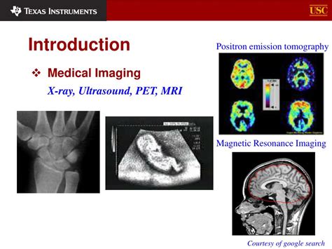 Ppt Ultrasound Imaging Powerpoint Presentation Free Download Id