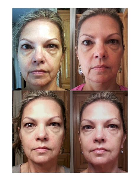 My 33 Day Change Top Left Is Before Nerium With 12 Other Products And