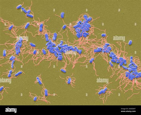 Salmonella Typhi Farbige Scanning Electron Micrograph Sem Von