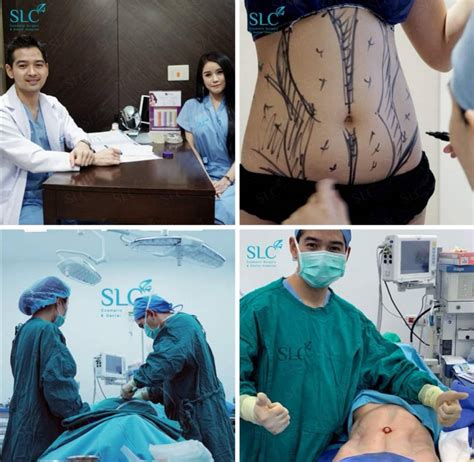 Vaser Lipo Selection Surgery Body Clinic Service Siam Laser