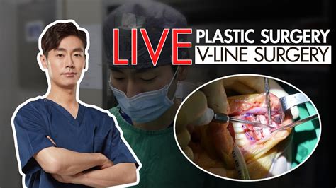 Live Plastic Surgery Videov Line Surgery 📍 Youtube