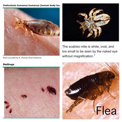 Bed Bugs Vs Scabies Moreoo