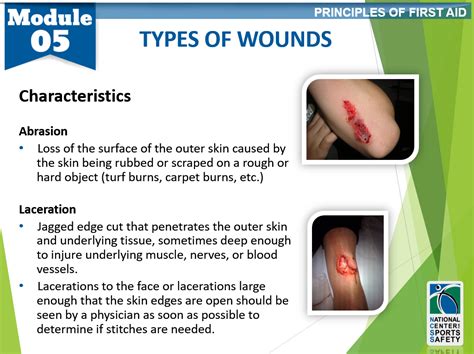 Wound Types Classifications