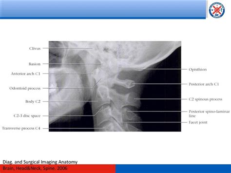 Radiology Of The Head And C Spine